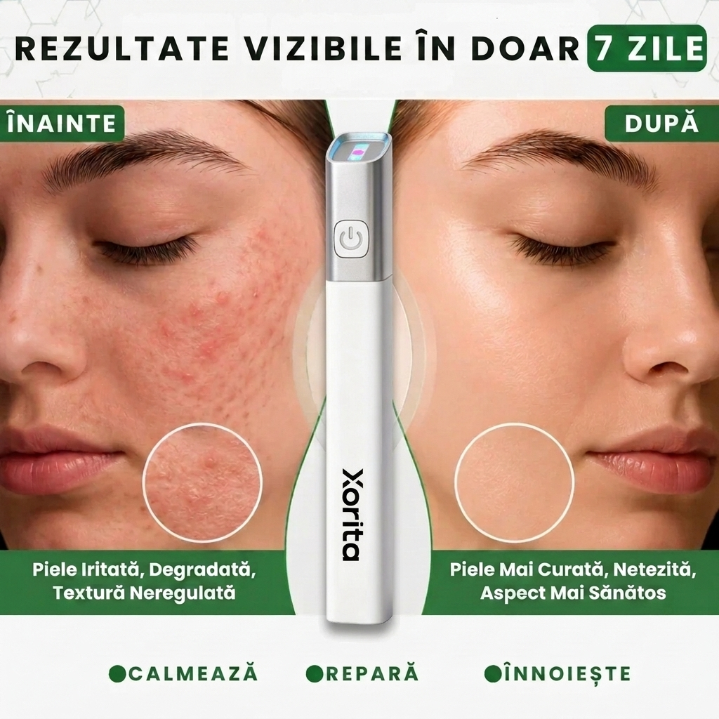 Dispozitiv Facial pentru Pete Pigmentare si Imperfectiuni